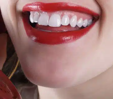 Close-up of smiling mouth displaying bright white teeth and red lipstick.