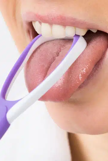 Close-up of person's mouth with purple and white tongue scraper removing coating from tongue.