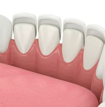 Healthy teeth and gums illustration showing proper dental anatomy and oral health structure.