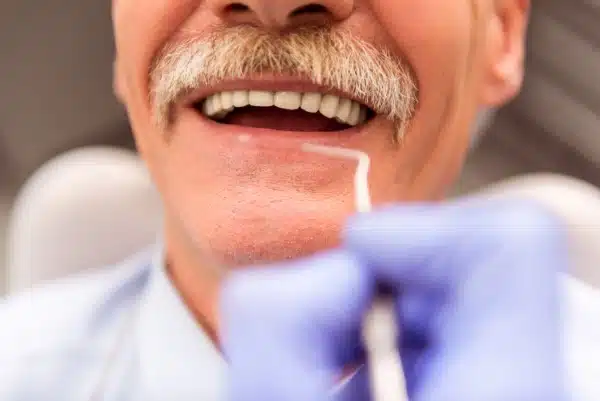Featured image for “DENTURES OFFER NUMEROUS ADVANTAGES TO PEOPLE WITHOUT TEETH”