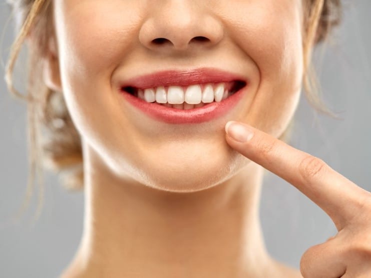 Woman smiling brightly, pointing to her teeth, demonstrating dental health and hygiene results.