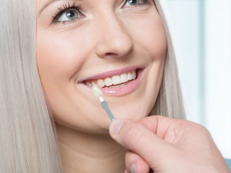 Woman smiling while pointing to her teeth during dental examination or consultation.