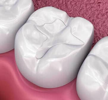3D dental model showing white tooth with pink gum tissue background for dental education.