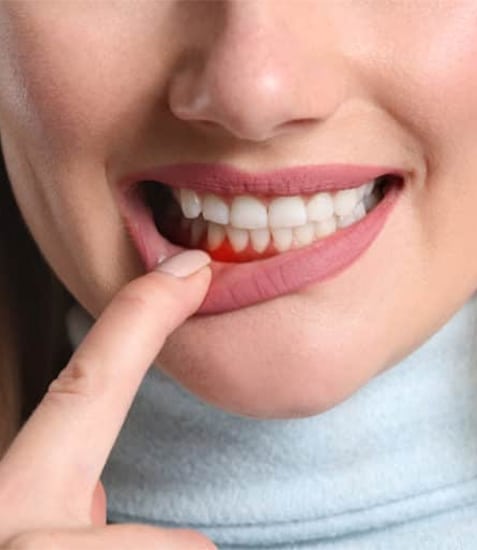 Close-up of woman smiling brightly, touching her lip, displaying healthy white teeth and gums.