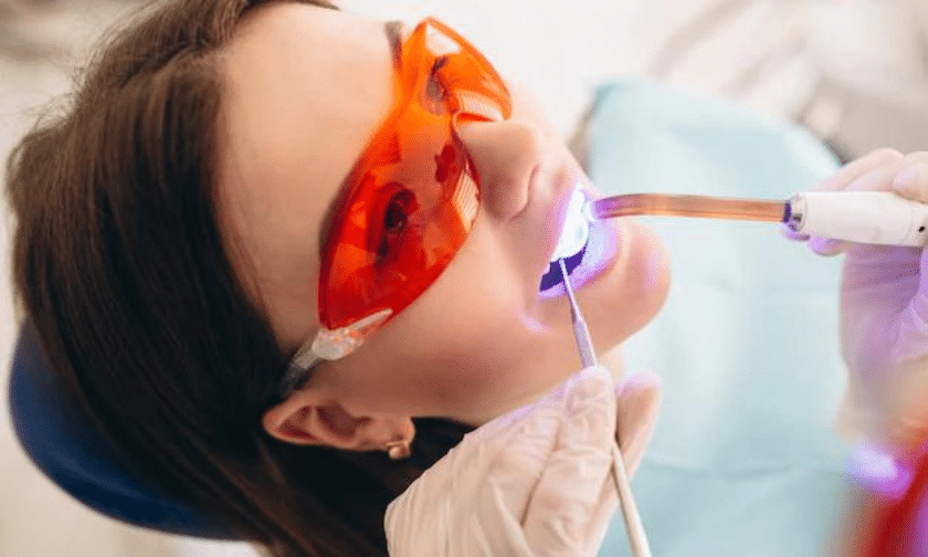 Teeth Whitening