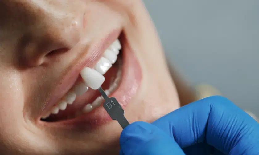 Featured image for “How Often Should One Get Dental Cleaning?”