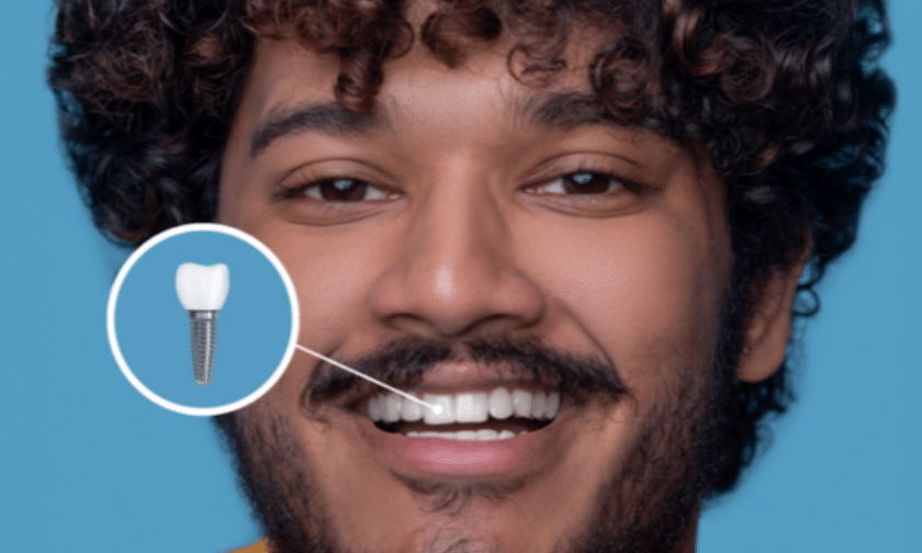 Featured image for “Why Should You Consider Getting Dental Implants From A Specialist”