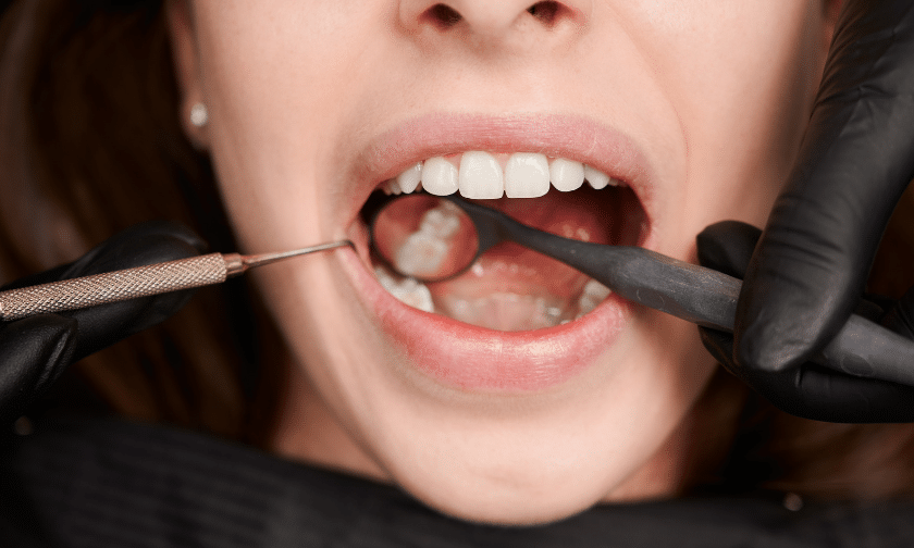 Featured image for “Understanding Tooth Sensitivity — Why It Happens and How to Fix It”