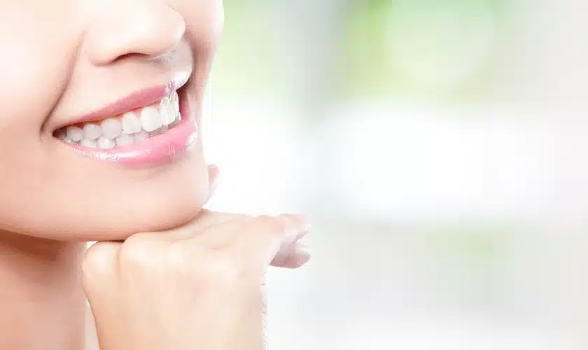 Teeth whitening