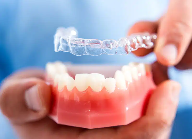 A model of teeth and Invisalign