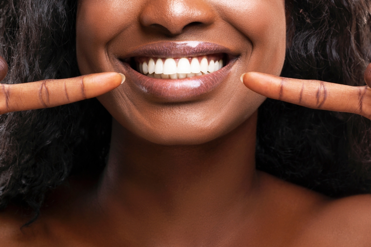 Featured image for “How Teeth Whitening Without Professional Help Impacts Your Oral Health”
