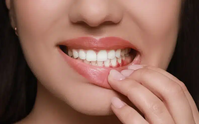 Featured image for “Signs of Gum Problems & When to Visit a Dentist”